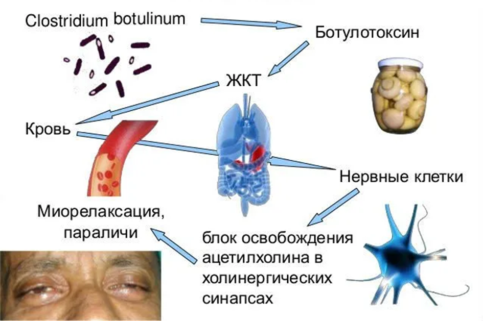 ВОЗБУДИТЕЛЬ БОТУЛИЗМА И ПИЩЕВОЕ ПРОИЗВОДСТВО